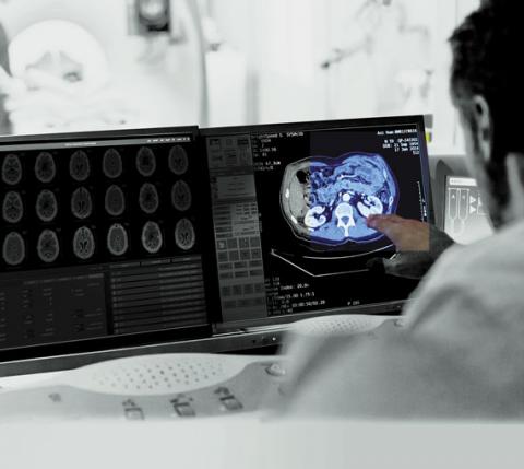 Neurology Image