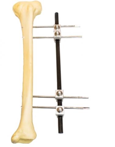 Tubular fixer type AO Image
