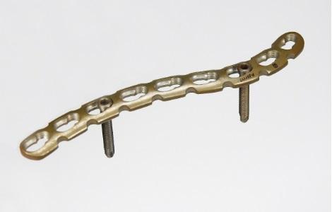 Clavicula plate in Anatomic S 3.5mm Image