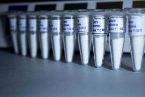 sugartest reducing sugar reagent Image