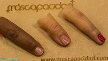 Finger prosthesis Image
