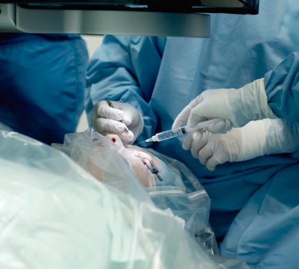 Cataract surgery Image