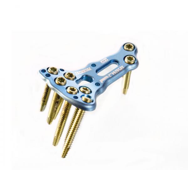 Affinity Distal Radius Plate Image